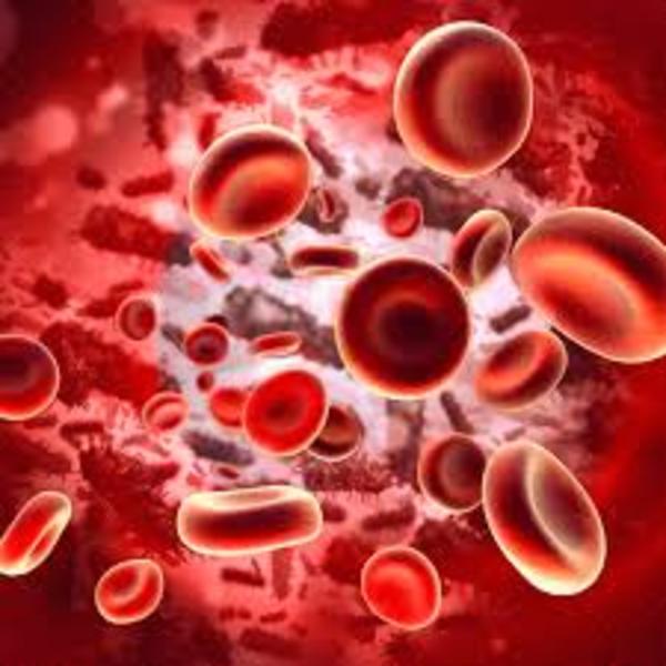 Large anemia
