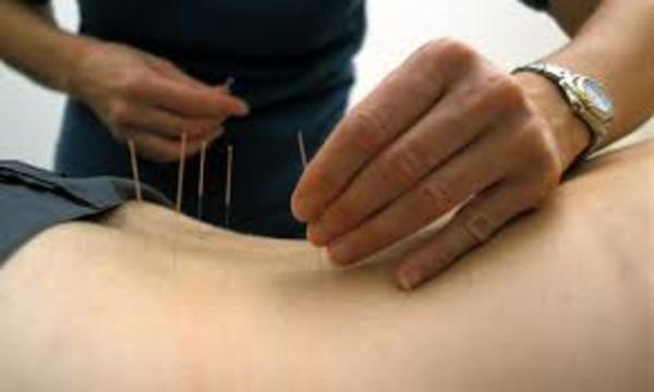 Large acupuntura e dor