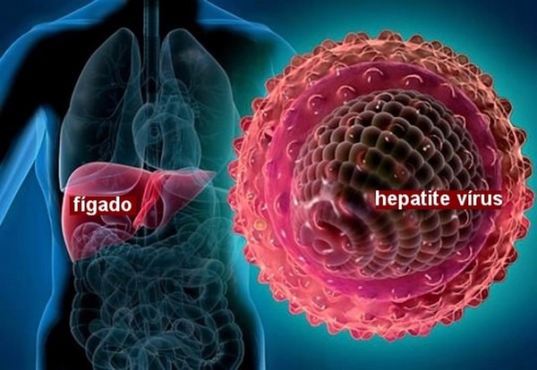 Large hepatites